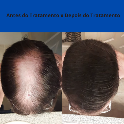 Resultado de aluno 1