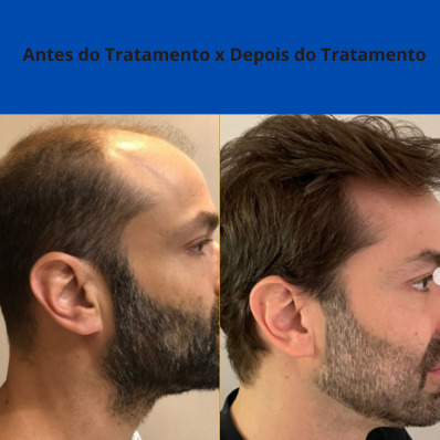 Resultado de aluno 2